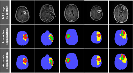 segmentation results