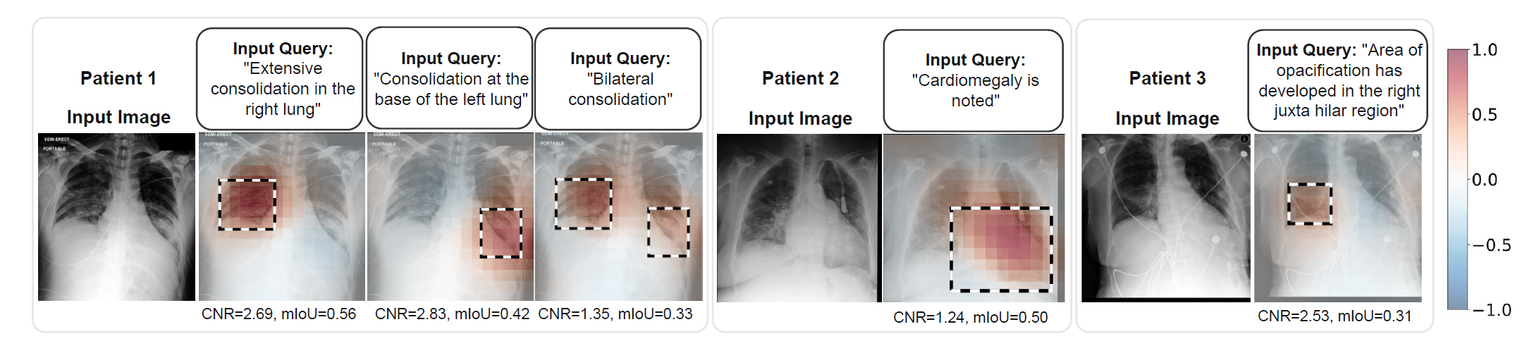 MS-CXR