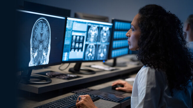 GPT-4's potential in shaping the future of radiology