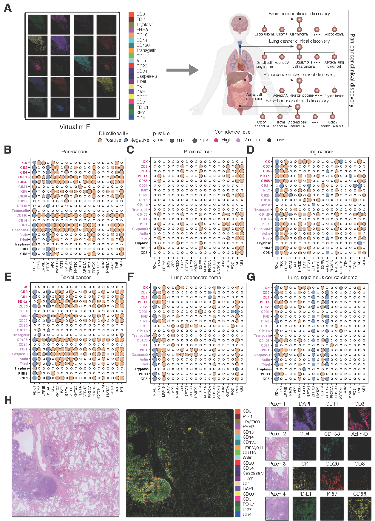 Figure 3. GigaTIME identifies novel TIME protein vs biomarker associations at pan-cancer, cancer type, cancer subtype levels. A, GigaTIME generates a virtual population of 14,256 with virtual mIF by translating available H&E images to mIF images, enabling pan-cancer, cancer type, and cancer subtype levels of biomedical discovery. B-G, Correlation analysis between protein channels in virtual mIF and patient biomarkers reveal TIME protein-biomarker associations at pan-cancer level (B), cancer-type level (C-E), and cancer-subtype level (F,G). Circle size denotes significance strength. Circle color denotes the directionality in which the correlation occurs. Channel color denotes high, medium, and low confidence based on pearson correlations evaluated using test set. H, A case study showcasing the activation maps across different virtual mIF channels for a H&E slide in our virtual population, and virtual mIF of sample patches from this slide.
